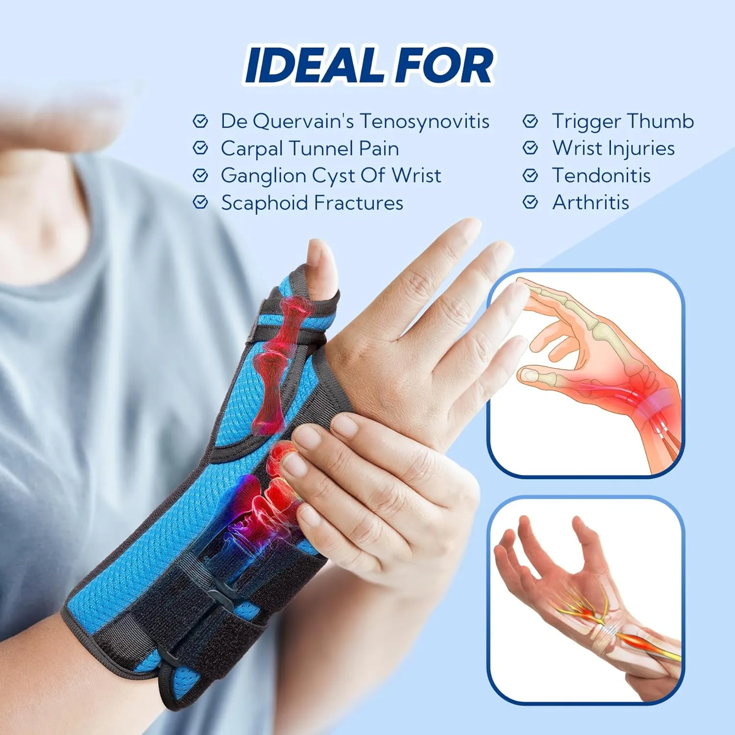 Thumb Spica Splint, De Quervain's Tenosynovitis Brace, Carpal Tunnel Wrist Brace with Thumb Support, Wrist and Thumb Brace for Trigger Thumb, Arthritis, Wrist Fractures, Injuries, Right-L